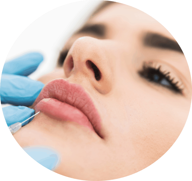 Lip Filler Portland Circle Image