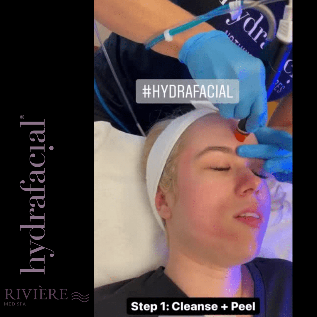 HydraFacial Portland Cleanse Peel