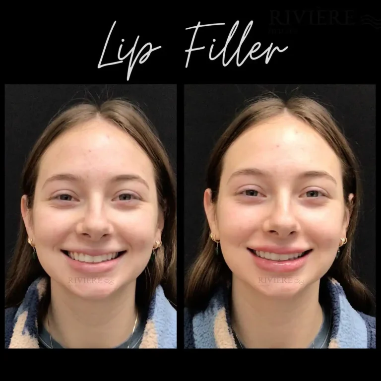 Your lips, naturally perfected.