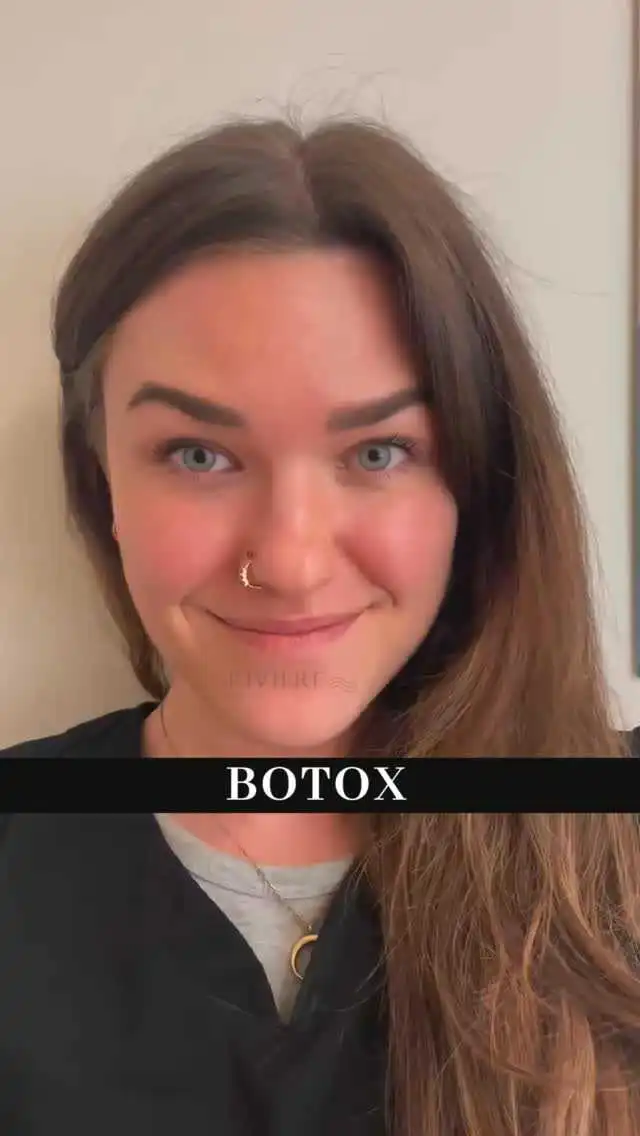 Botox at Rivière Med Spa Portland Oregon