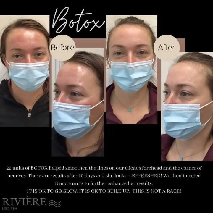 At Rivière Med Spa, we believe that doing right by you isn't just a goal — it's a promise we make every single day.