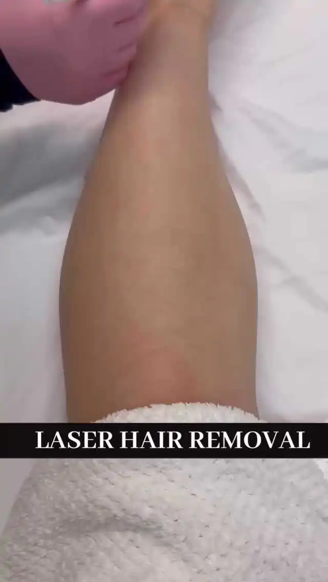 Laser Hair Removal at Rivière Med Spa Portland Oregon