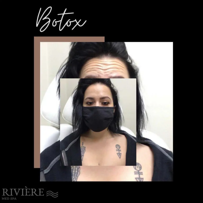 Before-and-after photos capture change, but they don't capture who you are.