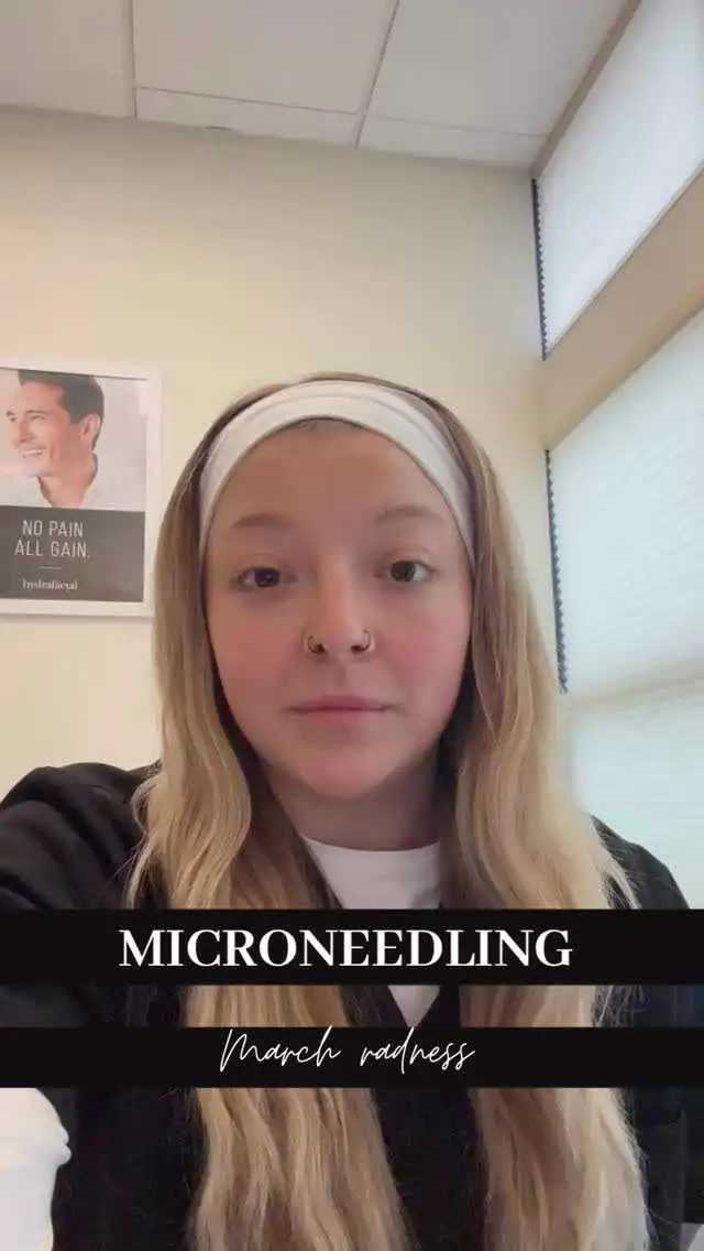 Microneedling at Rivière Med Spa Portland Oregon