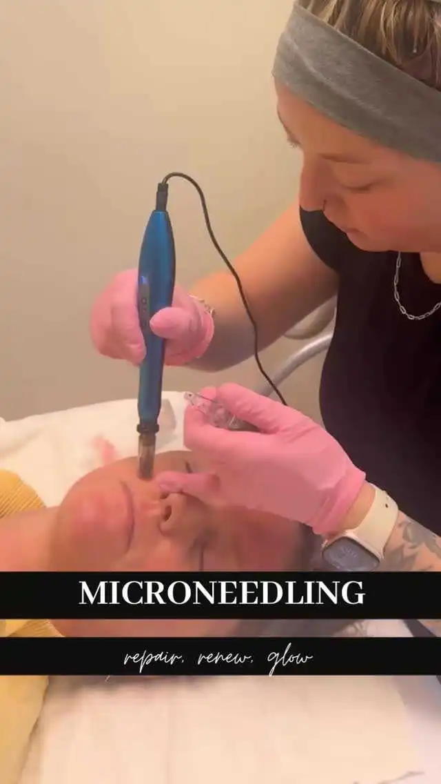 Microneedling at Rivière Med Spa Portland Oregon