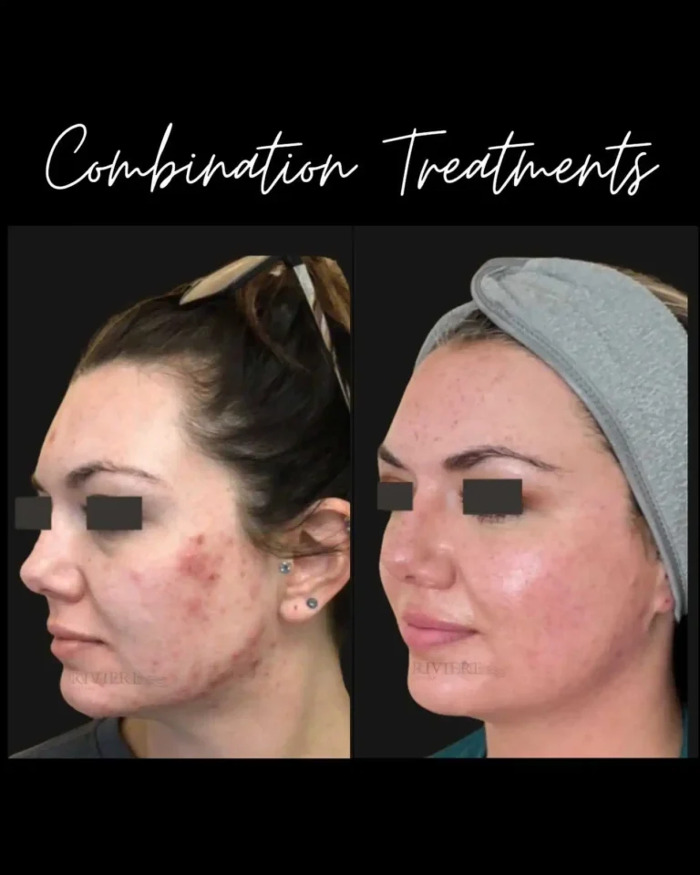 Why choose one treatment when your skin deserves more?