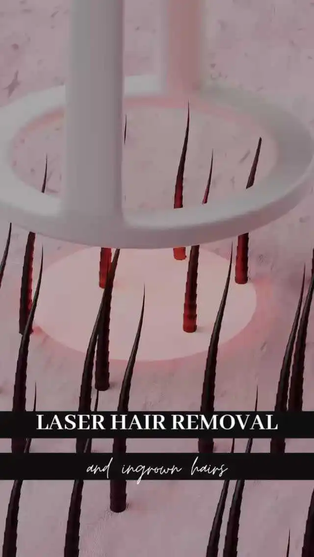 Laser Hair Removal at Rivière Med Spa Portland Oregon