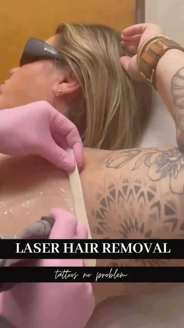 Laser Hair Removal at Rivière Med Spa Portland Oregon