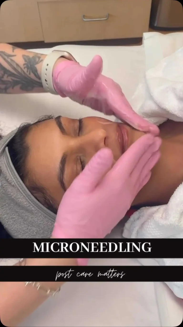 Microneedling at Rivière Med Spa Portland Oregon