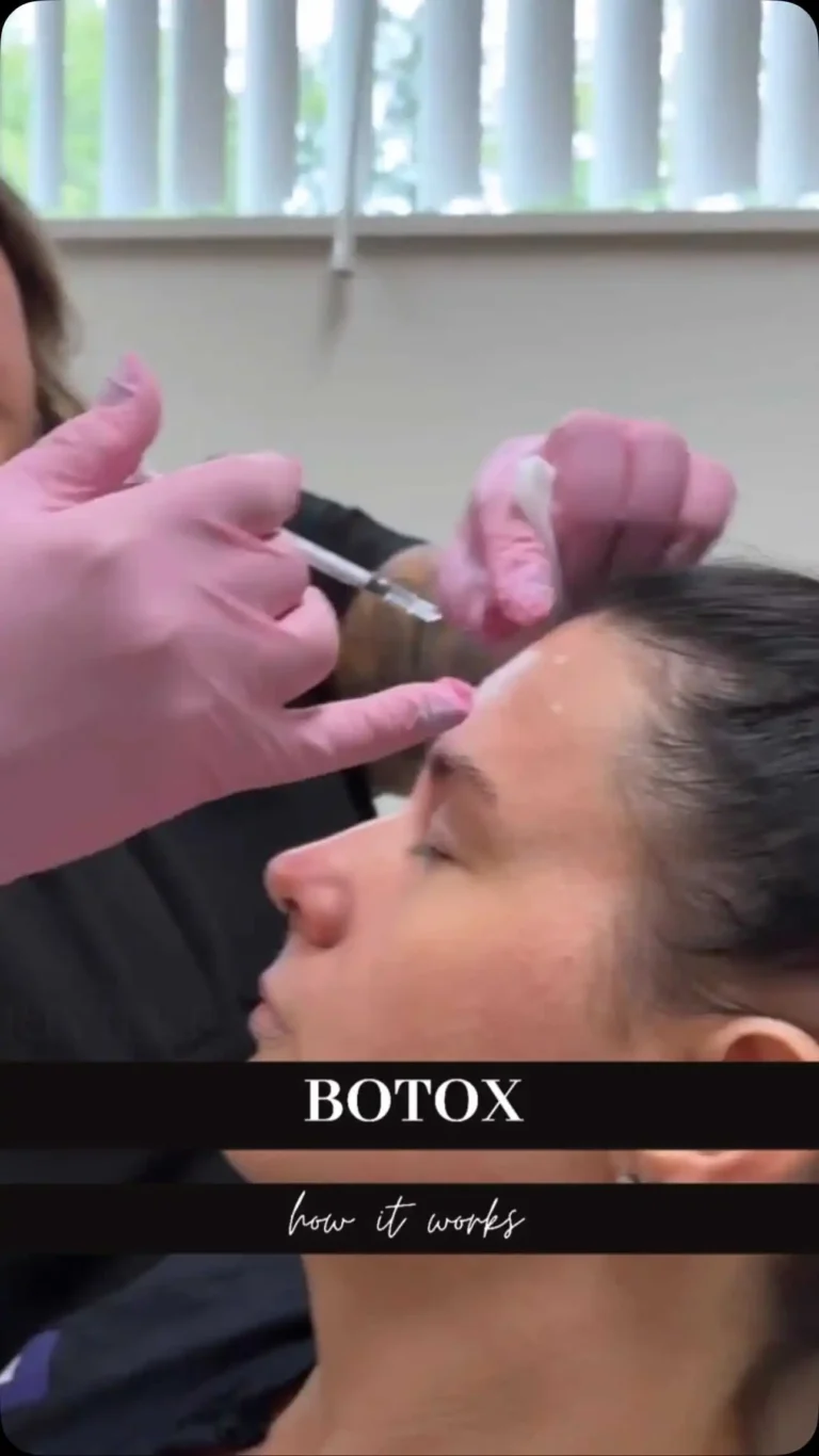 Botox at Rivière Med Spa Portland Oregon